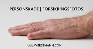 Personskadefoto og forsikringsfoto til méngradsvurdering
